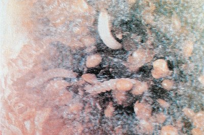 İncir içinde ekşilik böceği larvası